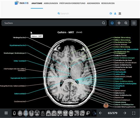 imaois|imaios free brain anatomy.